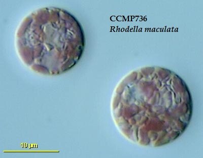 P. willinckii ’Bacteria’ TC 317 Hardy Diagnostic K317 Liquid Culture Media, Lactobacilli MRS